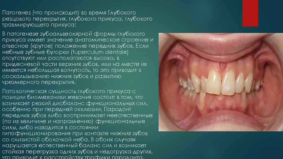 Патогенез (что происходит) во время Глубокого резцового перекрытия, глубокого прикуса, глубокого травмирующего прикуса: В