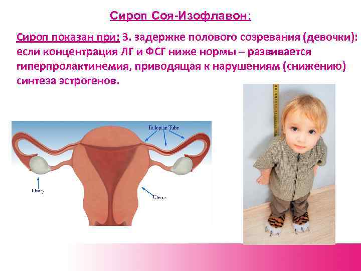 Сироп Соя-Изофлавон: Сироп показан при: 3. задержке полового созревания (девочки): если концентрация ЛГ и