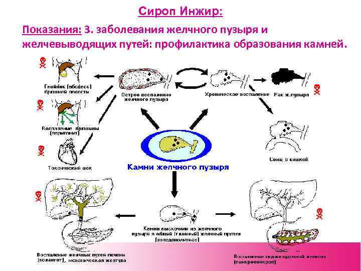 Сироп Инжир: Показания: 3. заболевания желчного пузыря и желчевыводящих путей: профилактика образования камней. 