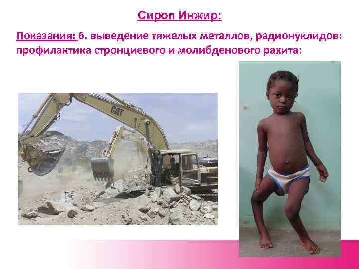Сироп Инжир: Показания: 6. выведение тяжелых металлов, радионуклидов: профилактика стронциевого и молибденового рахита: 