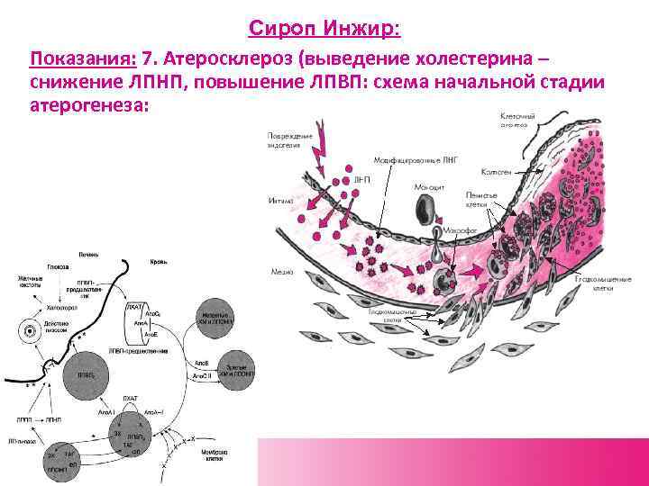 Сироп Инжир: Показания: 7. Атеросклероз (выведение холестерина – снижение ЛПНП, повышение ЛПВП: схема начальной