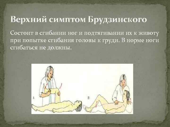 Верхний симптом Брудзинского Состоит в сгибании ног и подтягивании их к животу при попытке