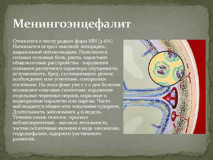 Менингоэнцефалит Относится к числу редких форм МИ (3 -6%). Начинается остро с высокой лихорадки,