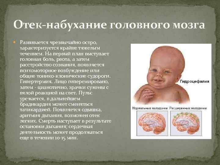 Отек-набухание головного мозга Развивается чрезвычайно остро, характеризуется крайне тяжелым течением. На первый план выступает