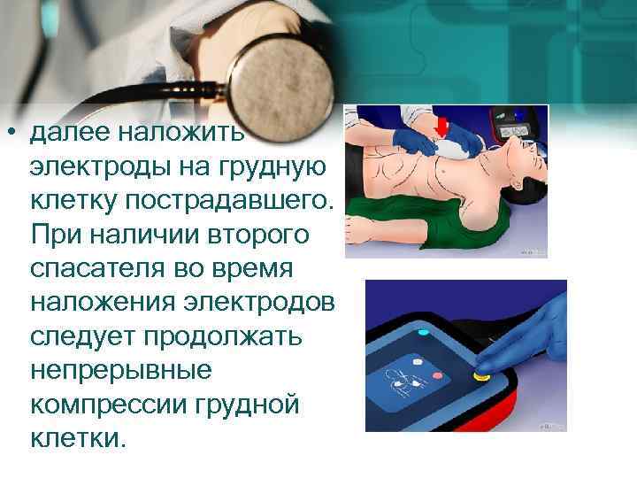  • далее наложить электроды на грудную клетку пострадавшего. При наличии второго спасателя во