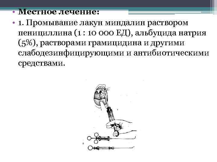  • Местное лечение: • 1. Промывание лакун миндалин раствором пенициллина (1 : 10