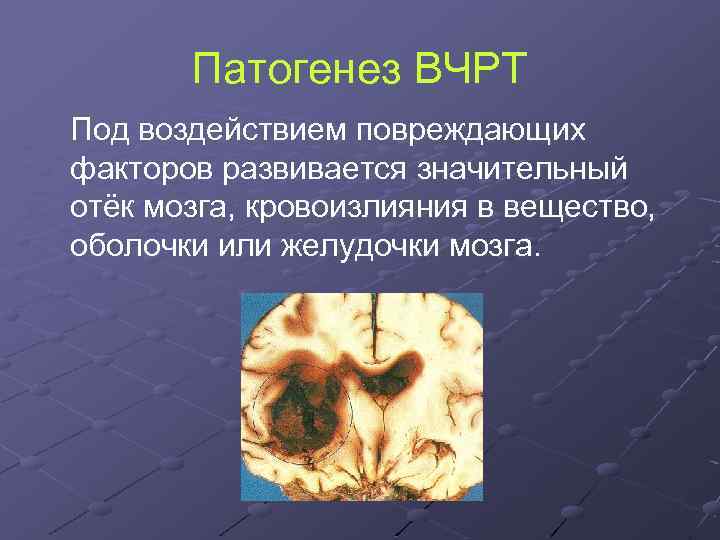 Патогенез ВЧРТ Под воздействием повреждающих факторов развивается значительный отёк мозга, кровоизлияния в вещество, оболочки