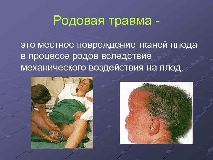 Родовая травма это местное повреждение тканей плода в процессе родов вследствие механического воздействия на
