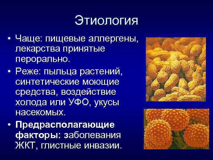 Этиология • Чаще: пищевые аллергены, лекарства принятые перорально. • Реже: пыльца растений, синтетические моющие