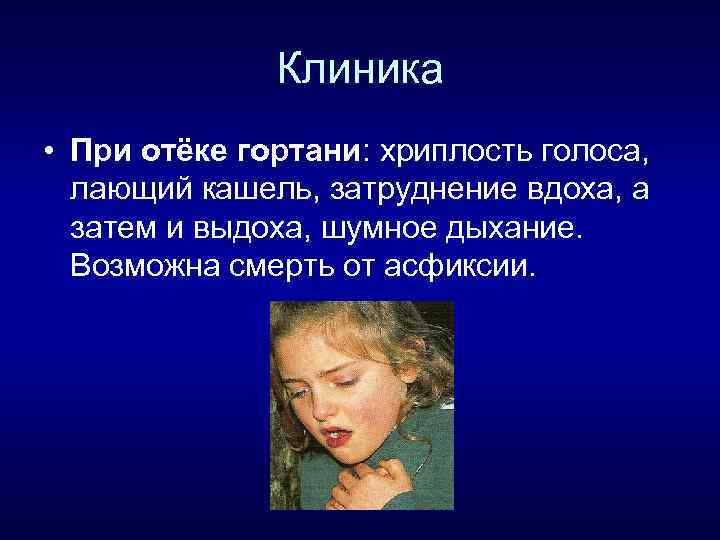 Клиника • При отёке гортани: хриплость голоса, лающий кашель, затруднение вдоха, а затем и