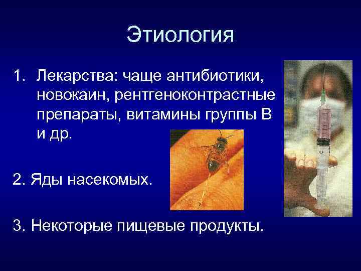 Этиология 1. Лекарства: чаще антибиотики, новокаин, рентгеноконтрастные препараты, витамины группы В и др. 2.
