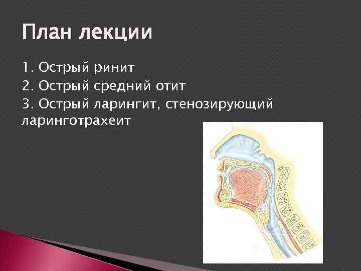 План лекции 1. Острый ринит 2. Острый средний отит 3. Острый ларингит, стенозирующий ларинготрахеит