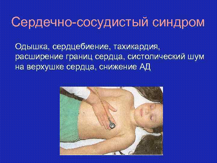 Сердечно-сосудистый синдром Одышка, сердцебиение, тахикардия, расширение границ сердца, систолический шум на верхушке сердца, снижение
