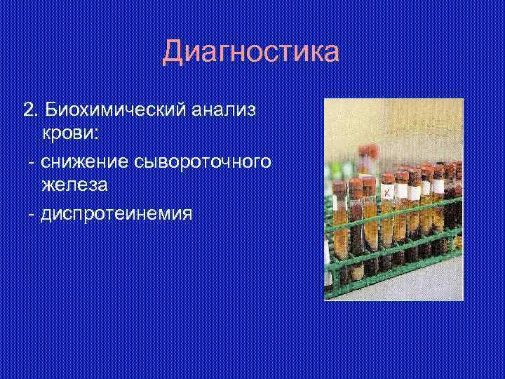 Диагностика 2. Биохимический анализ крови: - снижение сывороточного железа - диспротеинемия 