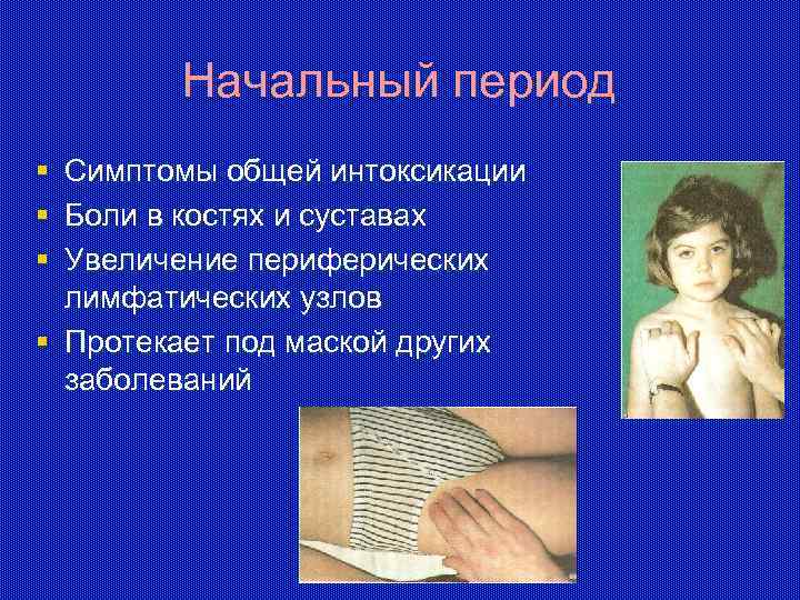 Начальный период § § § Симптомы общей интоксикации Боли в костях и суставах Увеличение