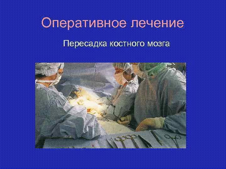 Оперативное лечение Пересадка костного мозга 