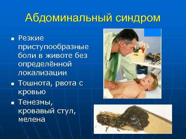 Абдоминальный синдром n n n Резкие приступообразные боли в животе без определённой локализации Тошнота,
