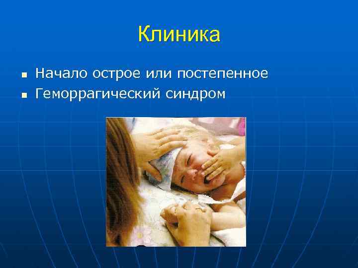 Клиника n n Начало острое или постепенное Геморрагический синдром 