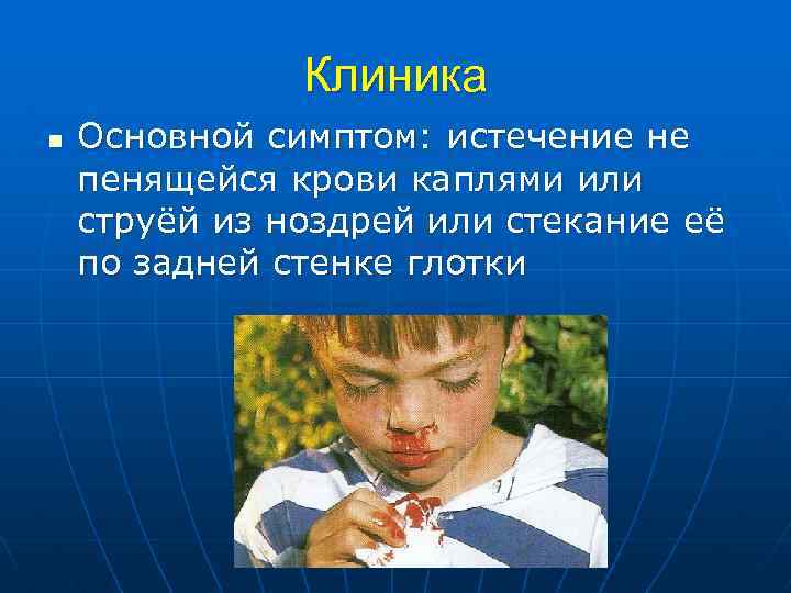 Клиника n Основной симптом: истечение не пенящейся крови каплями или струёй из ноздрей или