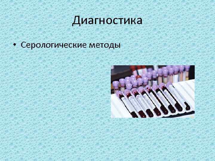 Диагностика • Серологические методы 