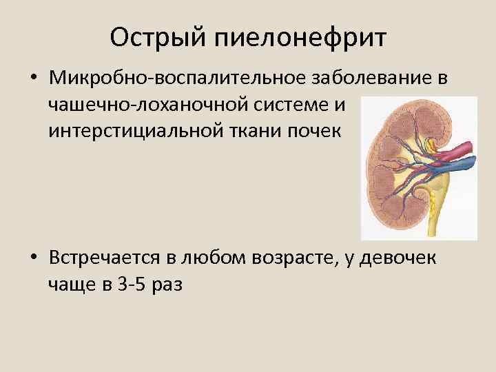 Острый пиелонефрит • Микробно-воспалительное заболевание в чашечно-лоханочной системе и интерстициальной ткани почек • Встречается