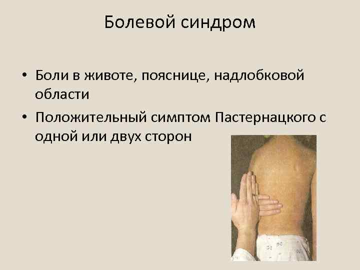 Болевой синдром • Боли в животе, пояснице, надлобковой области • Положительный симптом Пастернацкого с