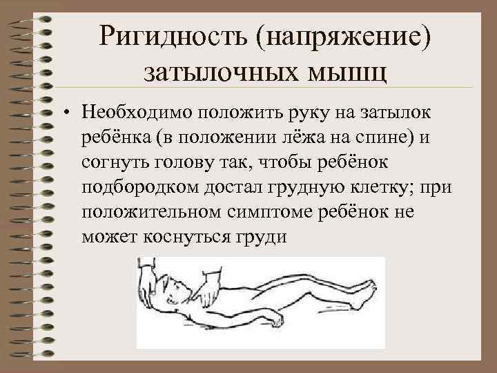 Ригидность (напряжение) затылочных мышц • Необходимо положить руку на затылок ребёнка (в положении лёжа
