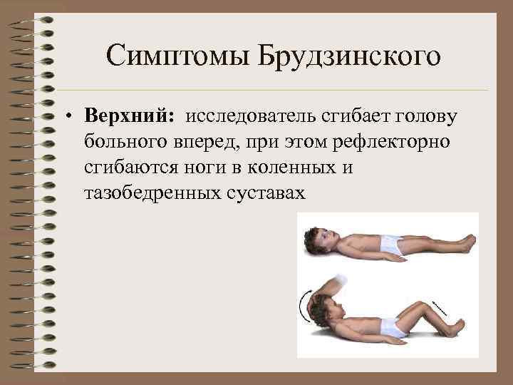 Симптомы Брудзинского • Верхний: исследователь сгибает голову больного вперед, при этом рефлекторно сгибаются ноги