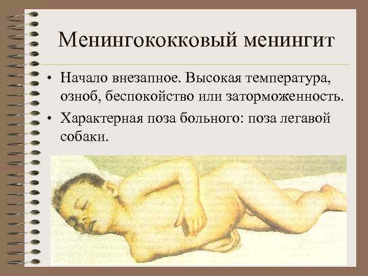 Менингококковый менингит • Начало внезапное. Высокая температура, озноб, беспокойство или заторможенность. • Характерная поза