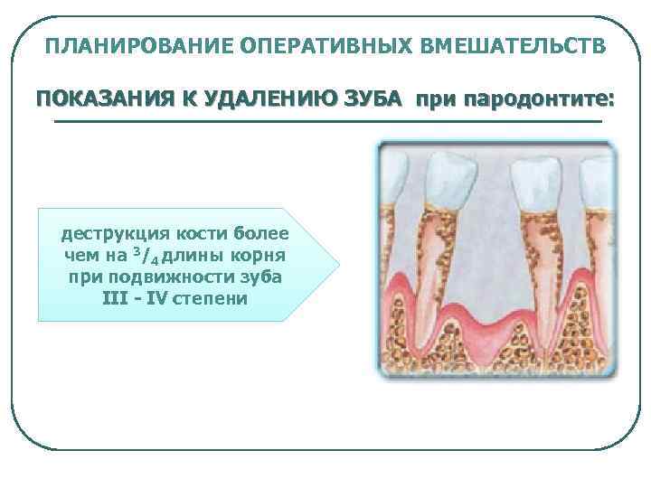 Подвижность зубов презентация