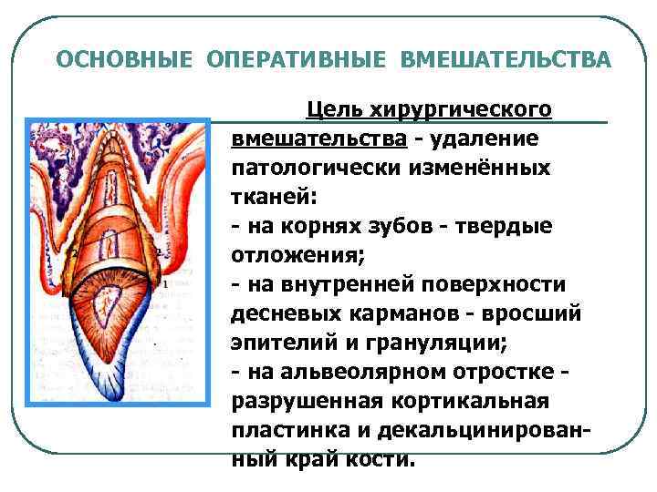 ОСНОВНЫЕ ОПЕРАТИВНЫЕ ВМЕШАТЕЛЬСТВА Цель хирургического вмешательства - удаление патологически изменённых тканей: - на корнях