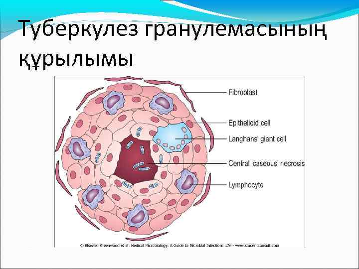 Туберкулез гранулемасының құрылымы 