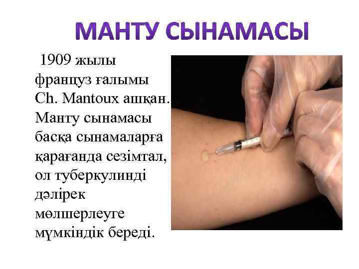 1909 жылы француз ғалымы Ch. Mantoux ашқан. Манту сынамасы басқа сынамаларға қарағанда сезімтал, ол