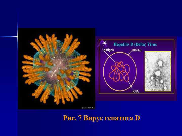 Рис. 7 Вирус гепатита D 