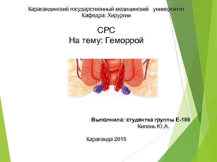 Карагандинский государственный медицинский университет Кафедра: Хирургии СРС На тему: Геморрой Выполнила: студентка группы Е-188