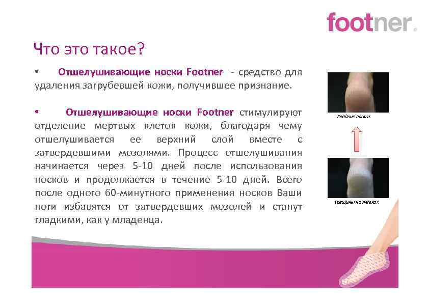 Что это такое? • Отшелушивающие носки Footner - средство для удаления загрубевшей кожи, получившее