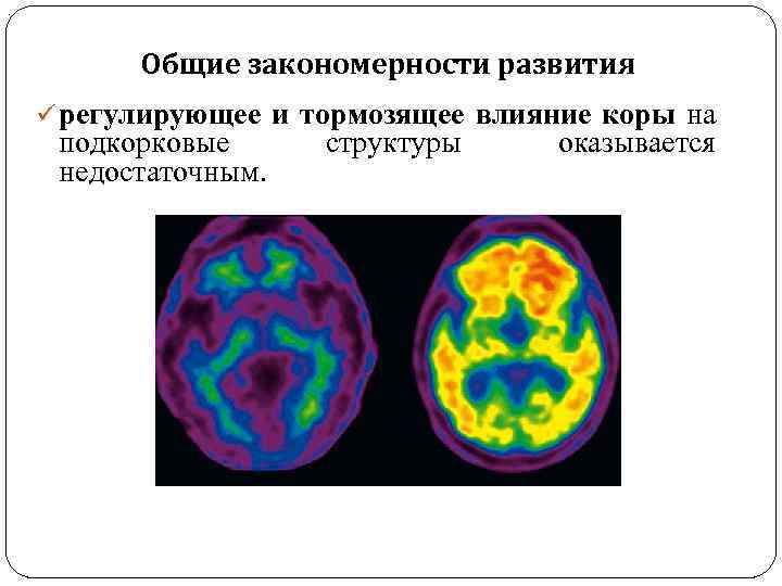 . Общие закономерности развития ü регулирующее и тормозящее влияние коры на подкорковые недостаточным. структуры
