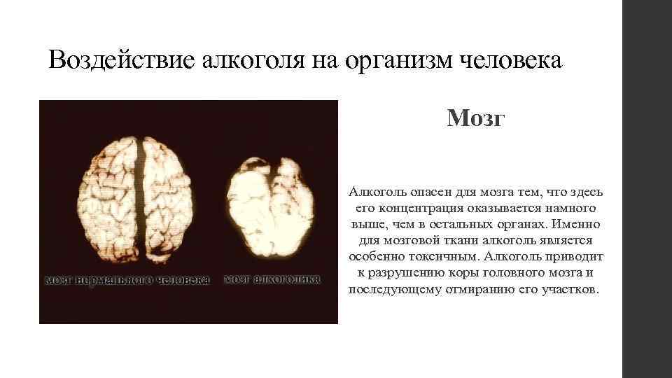 Воздействие алкоголя на организм человека Мозг Алкоголь опасен для мозга тем, что здесь его