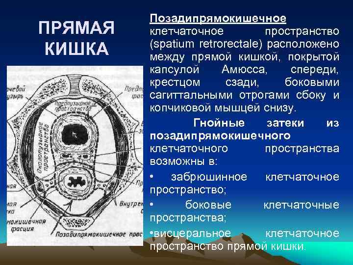 Поперечный распил малого таза на уровне 2 этажа схема