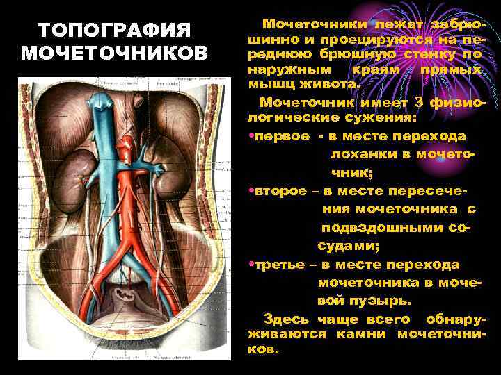 ТОПОГРАФИЯ МОЧЕТОЧНИКОВ Мочеточники лежат забрюшинно и проецируются на переднюю брюшную стенку по наружным краям