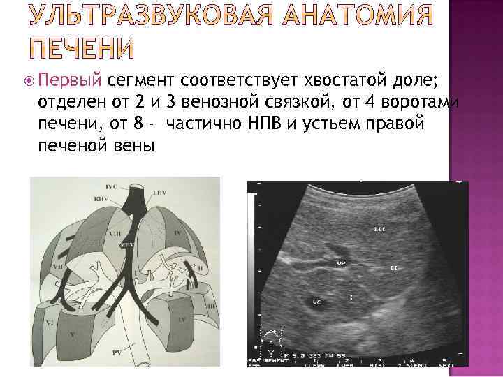  Первый сегмент соответствует хвостатой доле; отделен от 2 и 3 венозной связкой, от