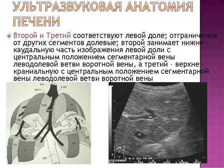  Второй и Третий соответствуют левой доле; отграничения от других сегментов долевые; второй занимает