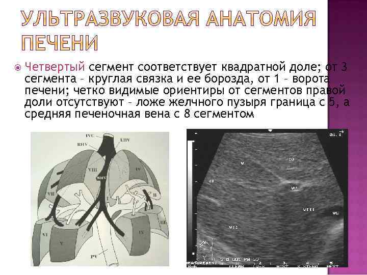  Четвертый сегмент соответствует квадратной доле; от 3 сегмента – круглая связка и ее