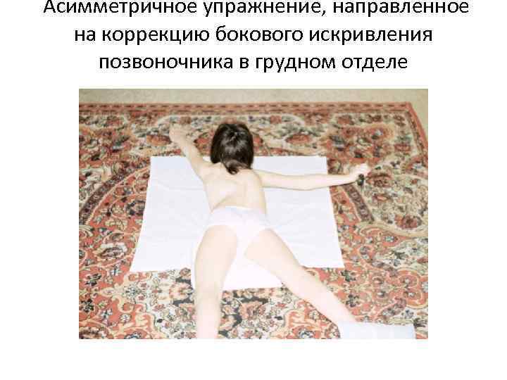  Асимметричное упражнение, направленное на коррекцию бокового искривления позвоночника в грудном отделе 