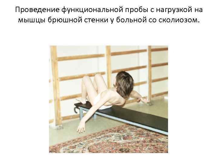 Проведение функциональной пробы с нагрузкой на мышцы брюшной стенки у больной со сколиозом. 