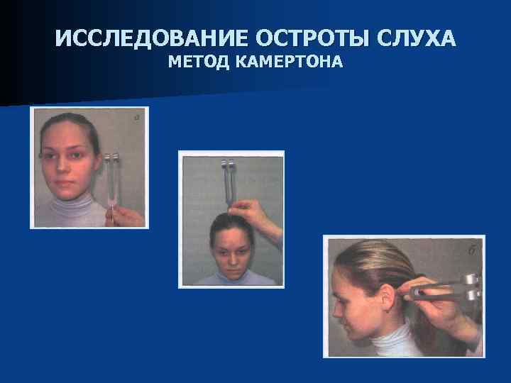 ИССЛЕДОВАНИЕ ОСТРОТЫ СЛУХА МЕТОД КАМЕРТОНА 