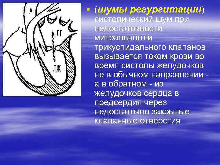 § (шумы регургитации) систолический шум при недостаточности митрального и трикуспидального клапанов вызывается током крови