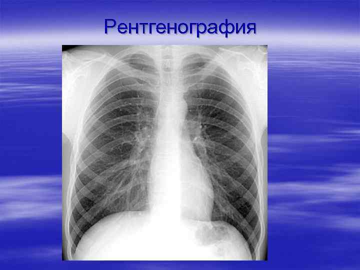 Рентгенография 