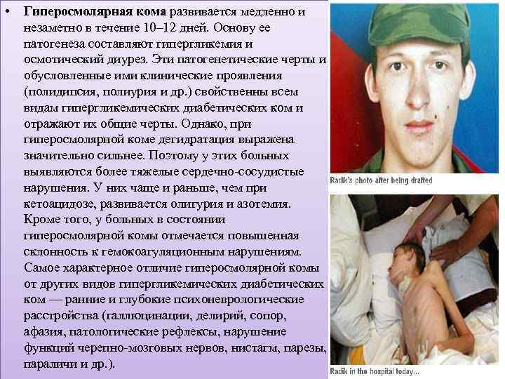  • Гиперосмолярная кома развивается медленно и незаметно в течение 10– 12 дней. Основу