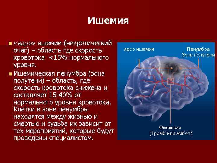 Ишемия n «ядро» ишемии (некротический очаг) – область где скорость кровотока <15% нормального уровня.